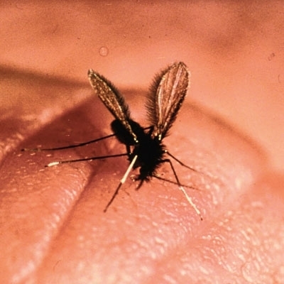 الليشمانيا مرض التهابي خطير...