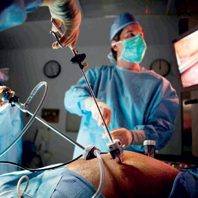 جراحة تصغير المعدة لتخفيض الوزن