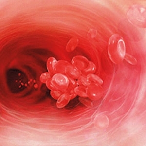 الهيموفيليا..