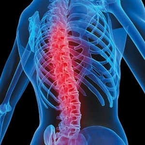 علاج أعصاب العمود الفقري 
