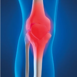 التهاب المفاصل وترقق العظام