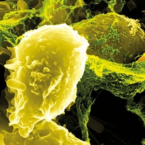 التسمم الوشيقي