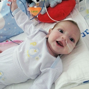 التهاب المفاصل التلقائي الشامل يصيب الأطفال بتشوهات لا عودة عنها