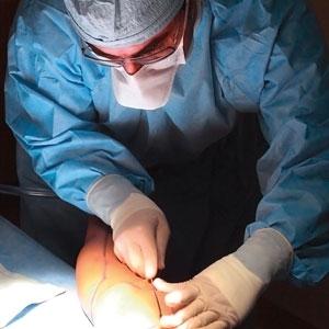 جراحة شفط الدهون