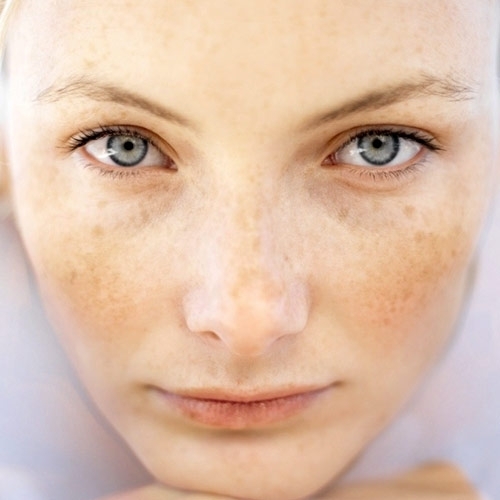 مشكلاتك الجلدية