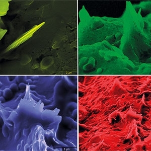 الكولسترول جزء لا يتجزأ من الجسم الصحيح