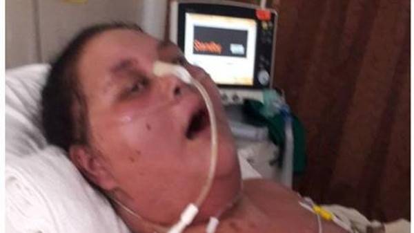 ما هو المرض الغامض الذي تسبب في وفاة صاحبة النصف طن؟