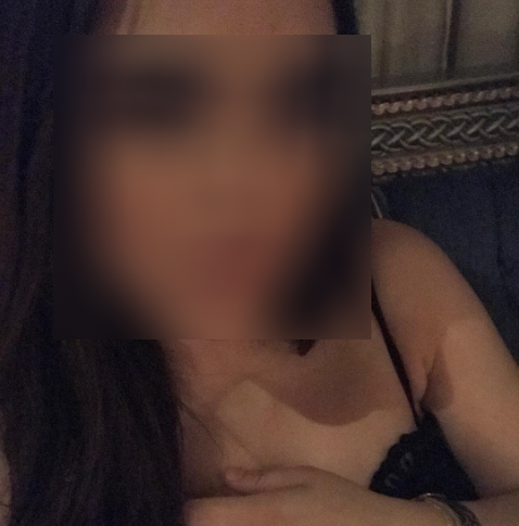 بالصور - فنانة عربية تكشف ما فعلته الابر التجميلية في وجهها وتحذر