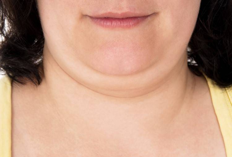 بعيداً عن التجميل.. 15 ثانية فقط يومياً للقضاء على دهون الذقن