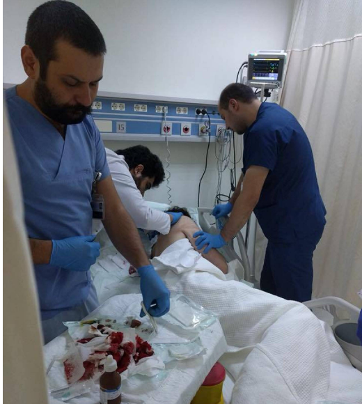 بالفيديو - فنّان سوري يلفق محاولة اغتياله والكذبة بانت