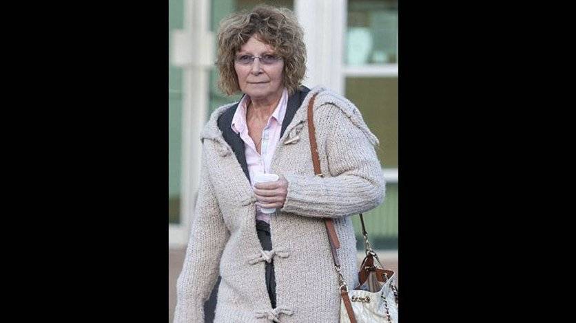 بالصورة - خضعت لحقن البوتوكس فوقعت المصيبة... شكلها مخيف