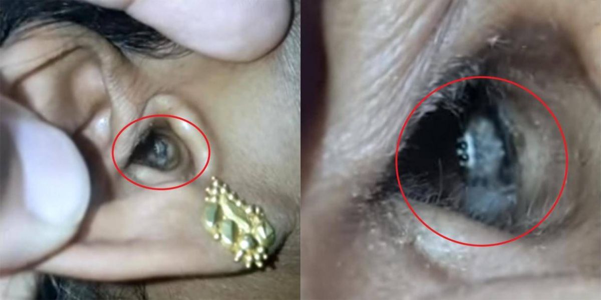 بالفيديو – عانت من ألم شديد في رأسها... شاهدوا ما الذي دخل إلى أذنها