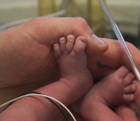 بالفيديو - ولادة أوّل طفل من سيّدة زرعت رحماً