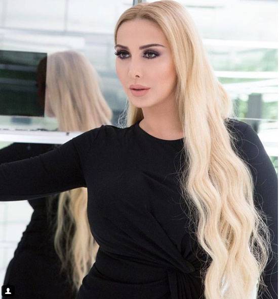 بالفيديو – جويل ماردينيان تلجأ إلى عيادة التجميل... هذا ما حقنت به بشرتها