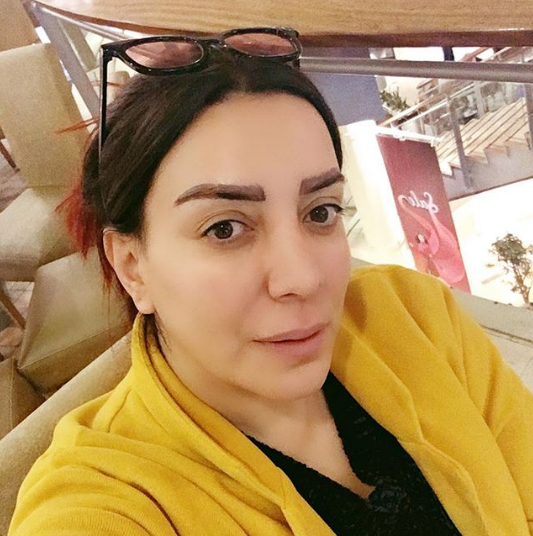 بالصور - شكران مرتجى تكشف كل الحقيقة عن عمليات التجميل