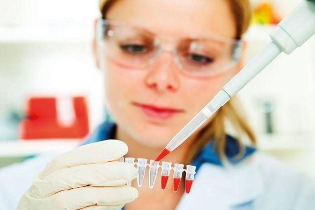 أحدث الوسائل لخفض الوزن بفاعلية مؤكدة DNA FIT Test حفاظاً على الرشاقة والصحة أيضاً