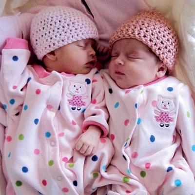 هل يجب فصل التوأمين عن بعضهما؟