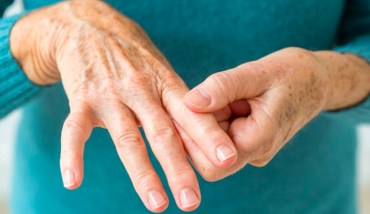 التهاب المفاصل ...عندما يكون تحسن مستوى المعيشة سببا في المرض