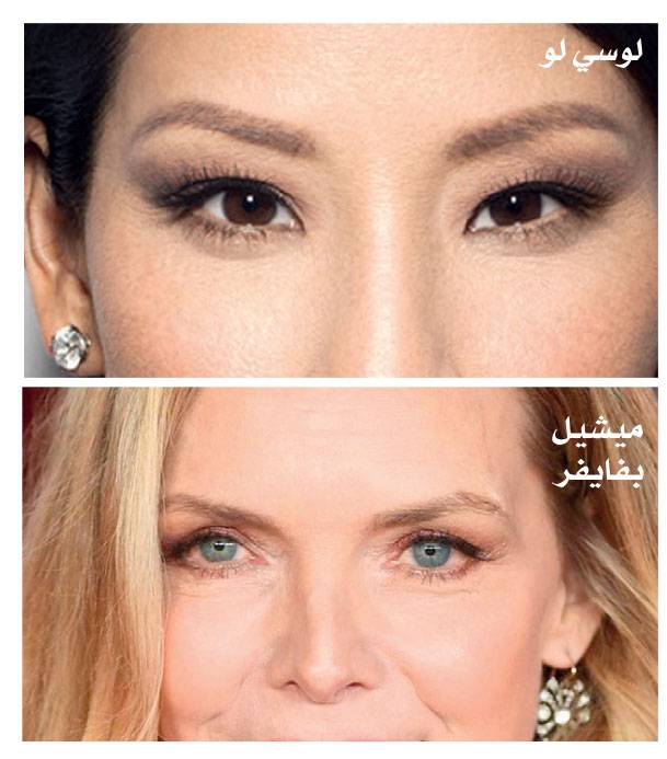 العيون المتباعدة