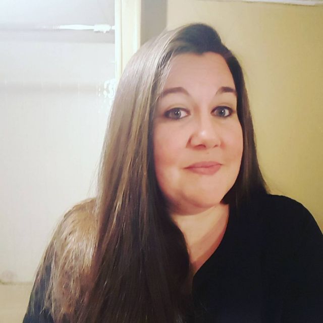 لا تدعي أولادك يلهون بشاحن الجوال... ما فعله بوجه هذه الطفلة مخيف