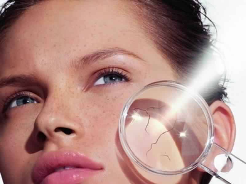 لطّفي حروق الشمس قبل فوات الأوان