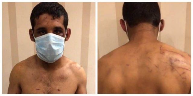 صدمة في واقعة اختطاف سعودي من ذوي الإعاقة وتعذيبه