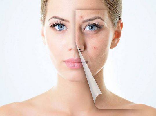 نصيحتان لتفادي ظهور البثور