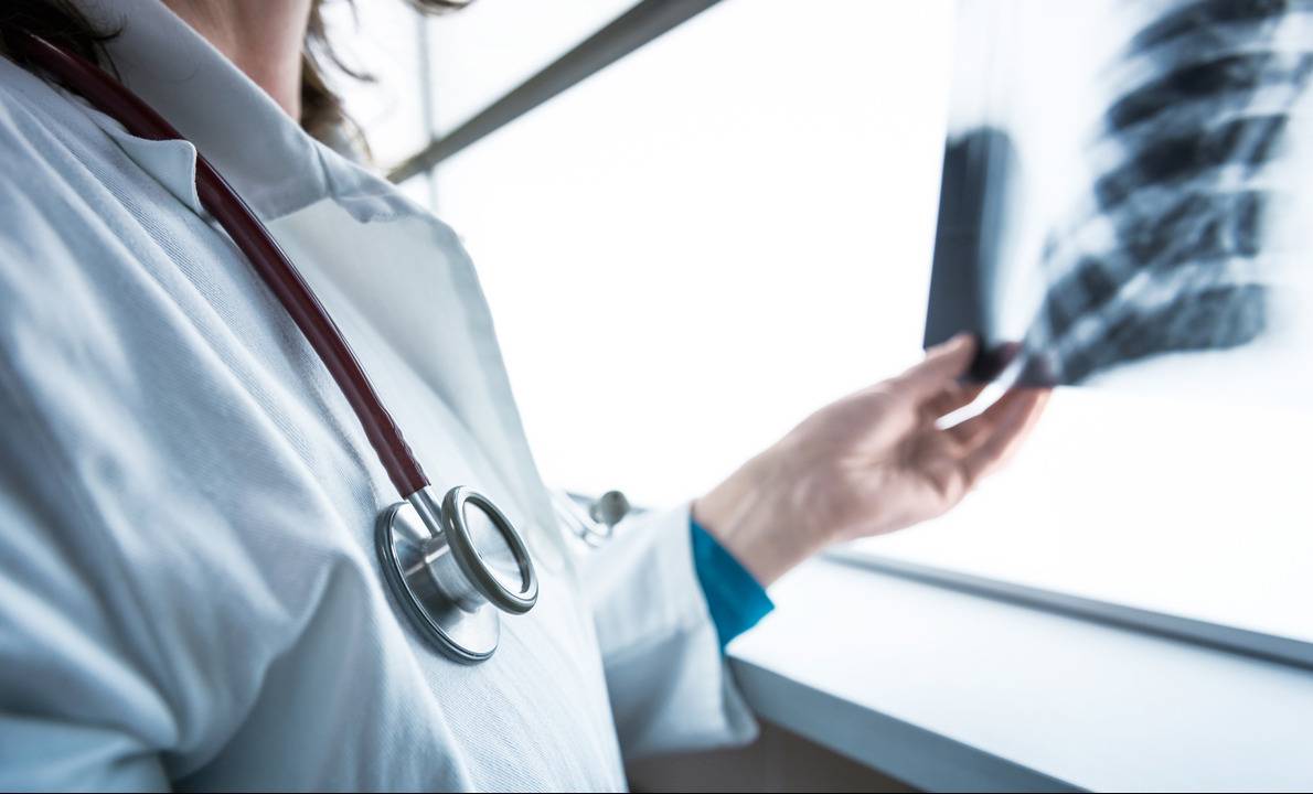 في دراسة تدعو للقلق: معدل سرطان الرئة لدى المرأة إلى زيادة بنسبة 43 في المئة....والسبب هو التدخين