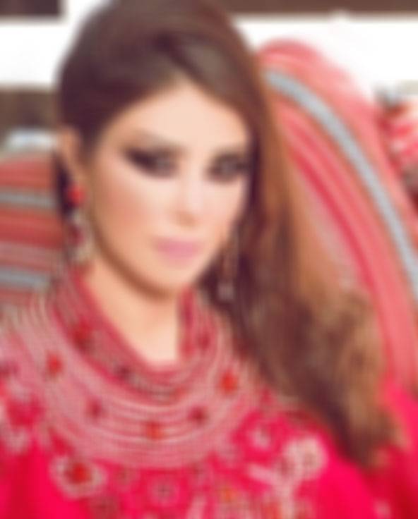 بالصورة – ممثلة سورية شهيرة تثير الجدل بتغيّر شكلها... والمتابعون 