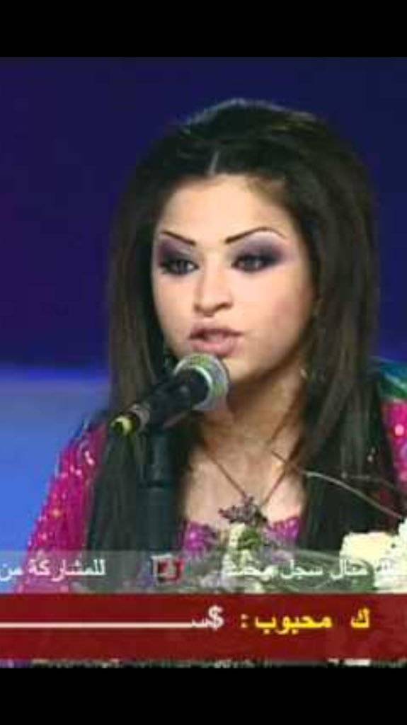 بالصور - لن تصدقوا من هي هذه النجمة العربية قبل عمليات التجميل