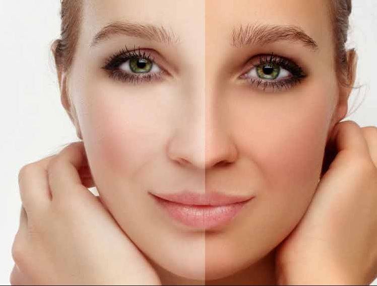 هل استخدام كريمات تفتيح البشرة خلال الحمل آمن؟