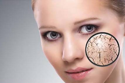 تعرفي على أفضل طرق علاج البشرة الجافة بالخلطات الطبيعية