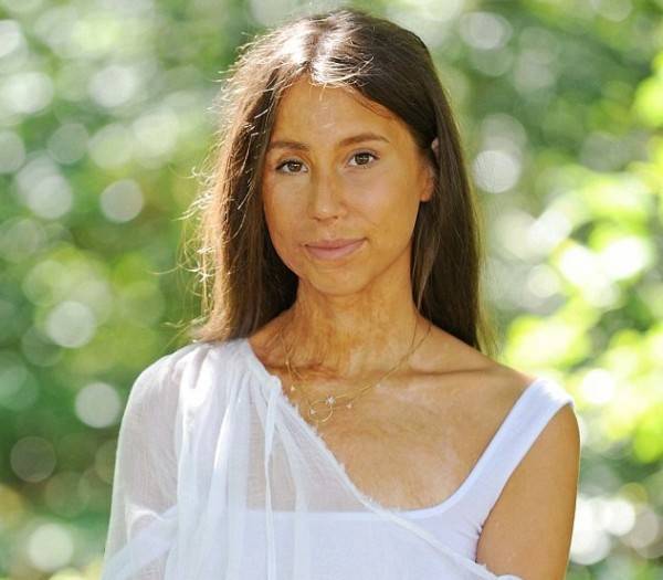 أحرقوا وجهها بالأسيد... هكذا كانت وهكذا أصبحت بعد 70 عملية تجميل