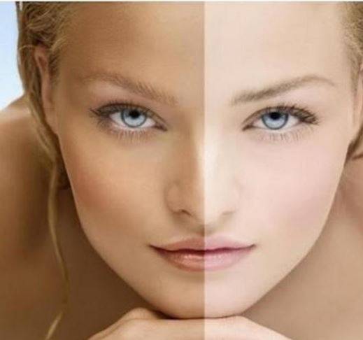 لتبييض الجسم ... طريقة تبييض المنطقة الداخلية للفخذين