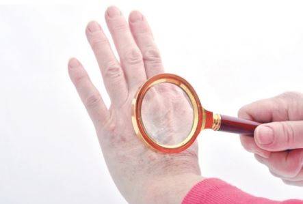 تعلّمي تفتيح البقع الداكنة المنتشرة على سطح اليدين