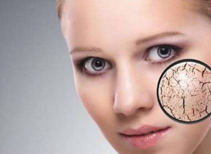 بالمقادير - تعلّمي تحضير أقنعة طبيعية لعلاج البشرة الجافة... نتيجتها سريعة ورائعة