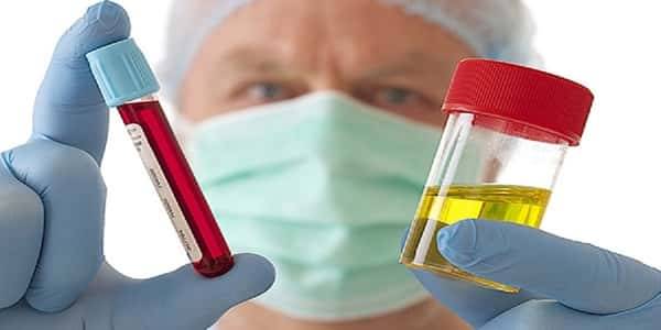 ظهور الدم في البول يدعو للقلق في هذه الحالات