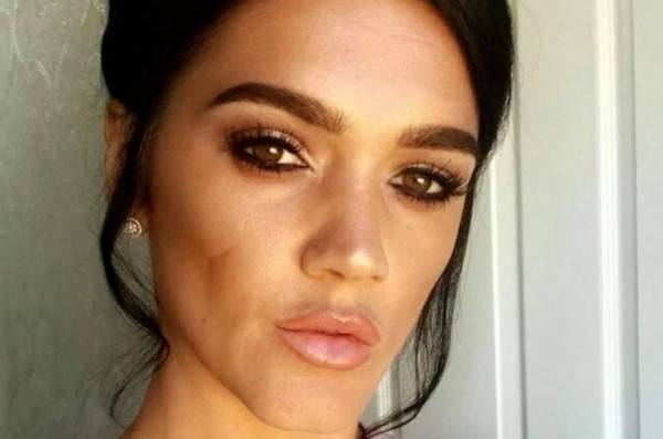 بالصور - عملية رفع المؤخرة تودي بحياة هذه الشابة