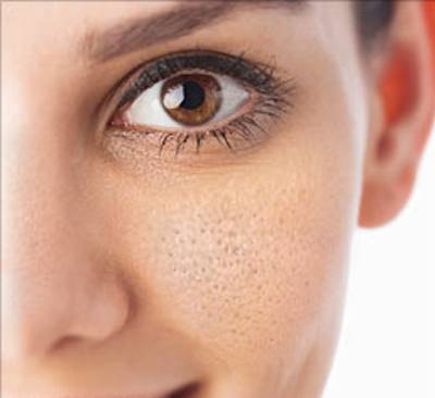 كيف تتخلّصين من المسامات الواسعة؟.. الرقم 3 في غاية السهولة