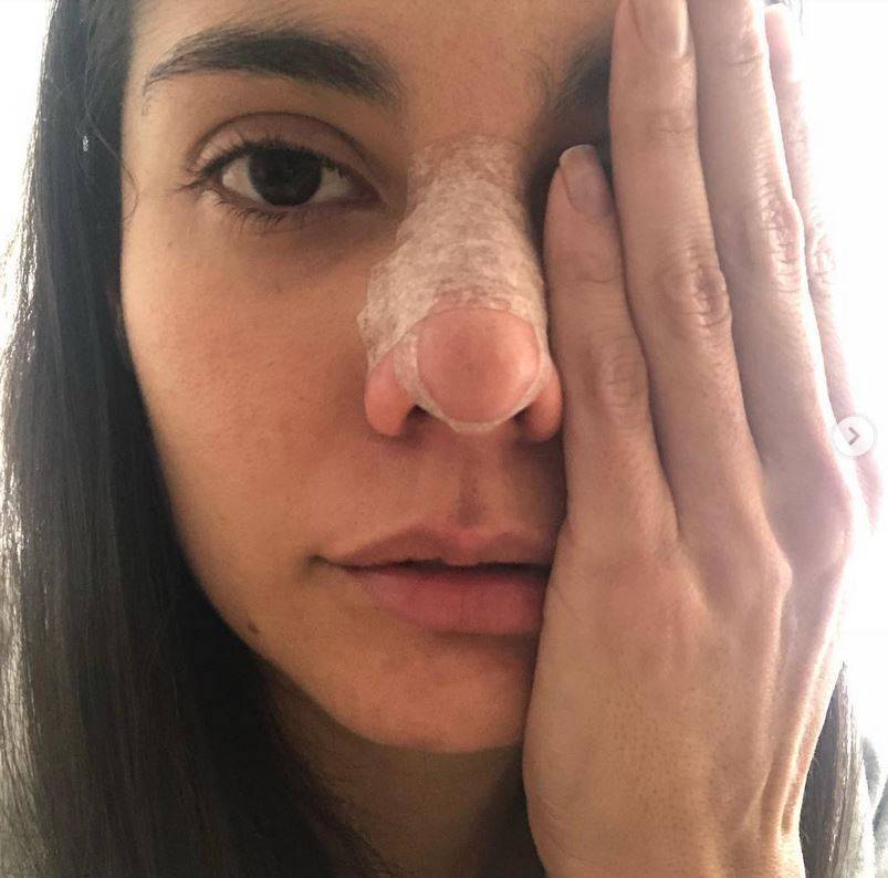 فنانة شهيرة تنشر صورها بعد ضرب زوجها لها... شاهدوا ما فعله بوجهها