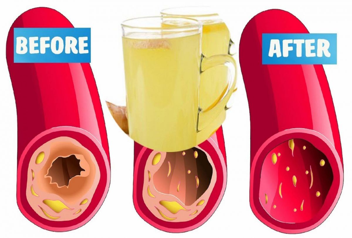 اليكم وصفة مشروب سحري يحارب انسداد الشرايين ويدعم القوة الجسدية