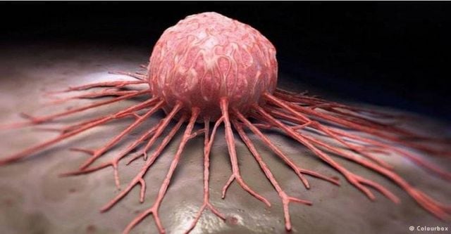 سرطان الثدي وغيره من السرطانات الأكثر قابلية للشفاء