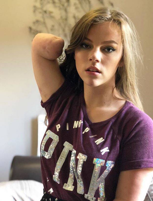 بالفيديو – رغم يديها المبتورتين... فتاة تطبق الماكياج على وجهها مثل الخبيرات