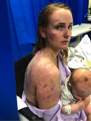 مواقع التواصل تتوج أماً أسترالية بلقب المرأة الخارقة