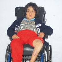 الطفلة الفلسطينية المعاقة حركيا نعمة...