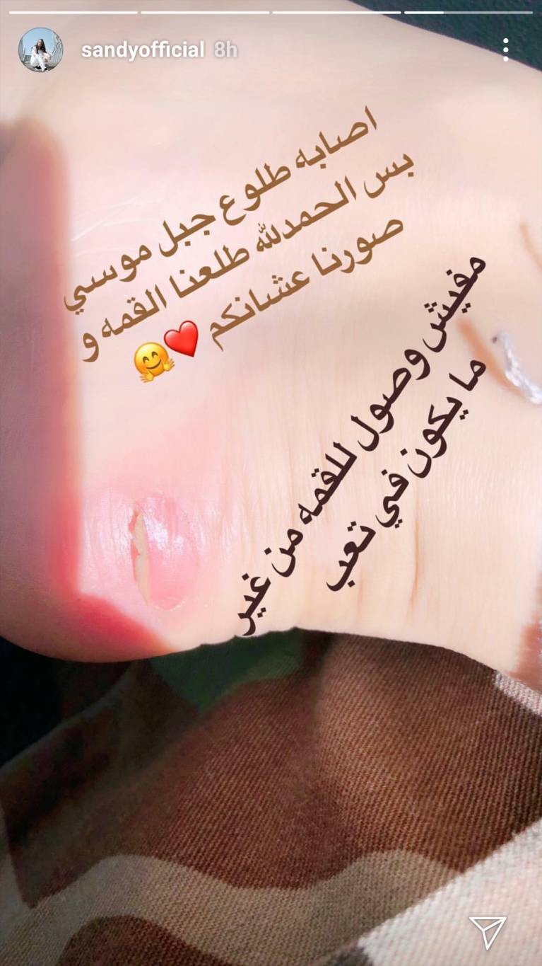 مطربة تتعرض لإصابة خلال صعود جبل موسى.. من هي؟
