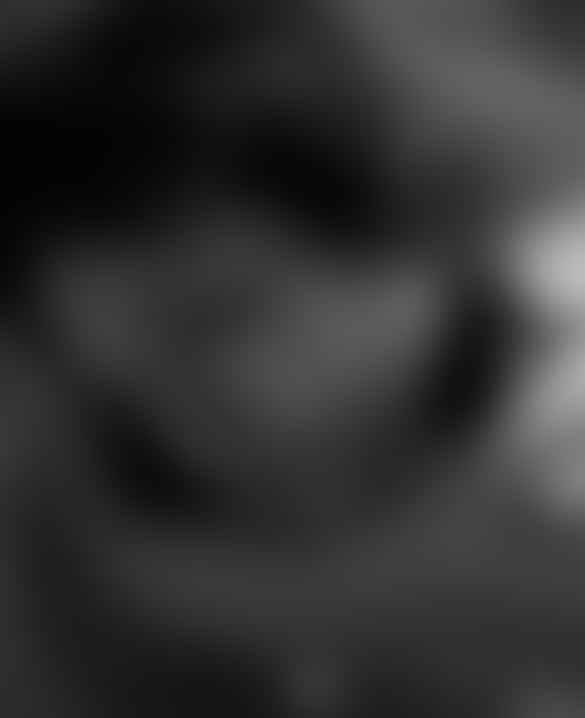 بالصورة: فنانة تتعرض لحروق في يدها.. وماذا فعلت بسبب صورها الجريئة؟