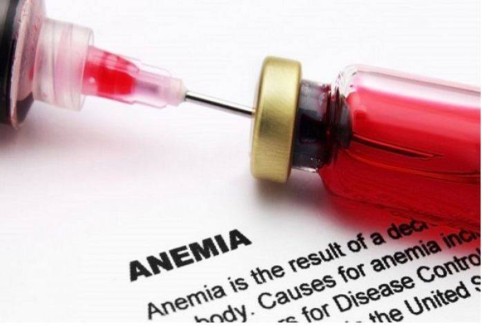 تعرفوا إلى كيفية علاج فقر الدم بالأعشاب