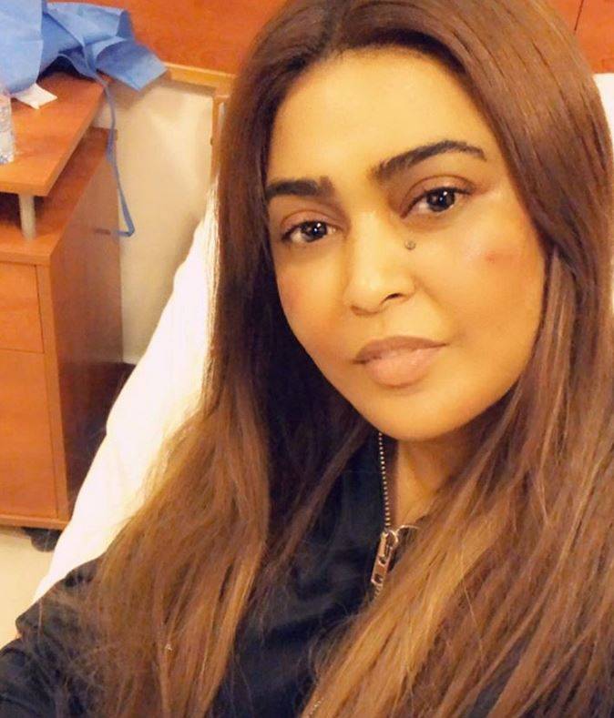 بالفيديو –وعد بمنظر صادم ووجه مليء بالبقع... ما الذي فعلته 