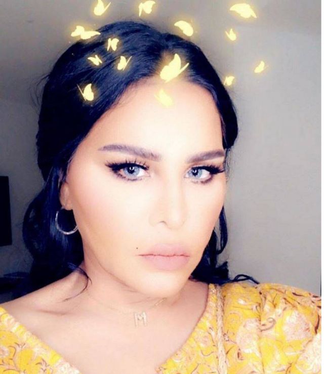 بالفيديو والصور – تغييرات تثير الجدل في وجه أحلام... ما قصة الانتفاخ وماذا حلّ بشعرها؟